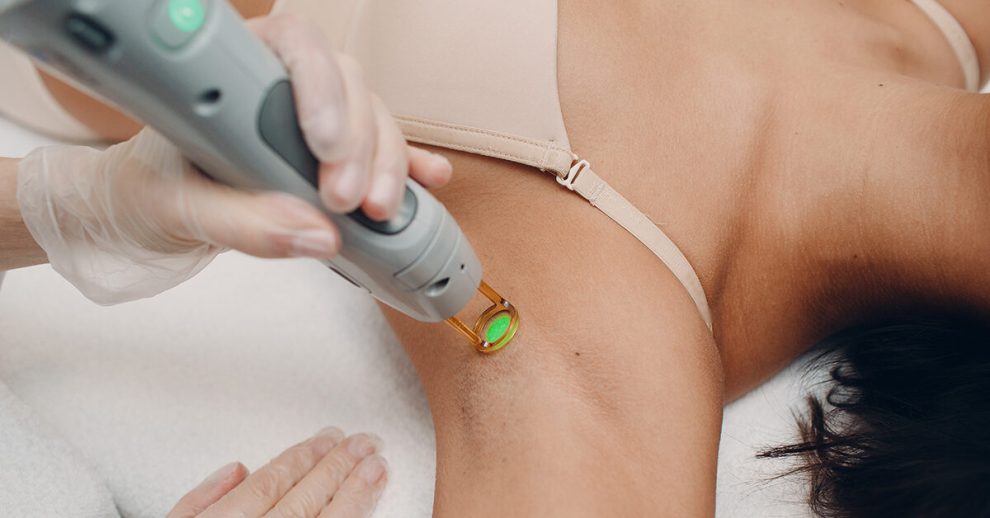 Benefits for Laser Hair Removal