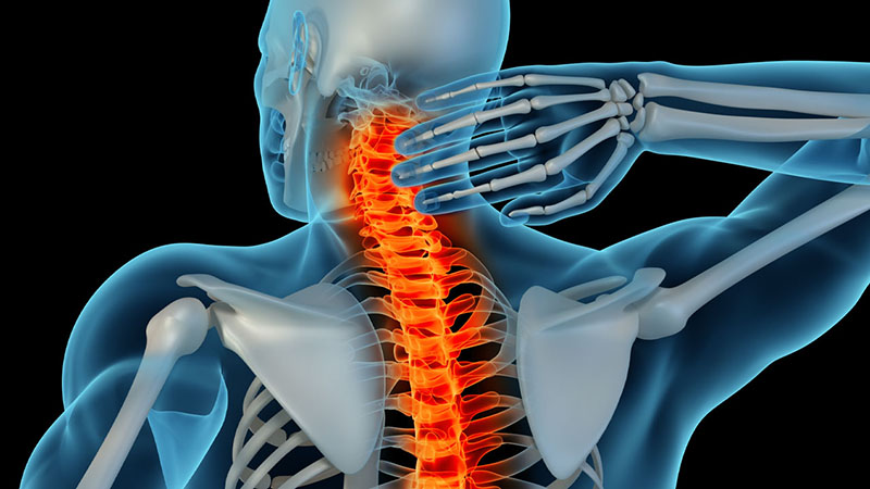 What-Can-Cause-a-Spinal-Stroke