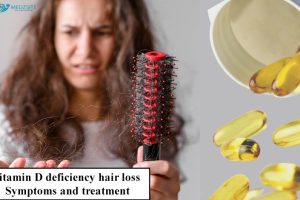 hair loss