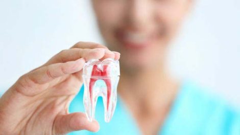 how long do root canals take