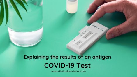 At Home Covid 19 RT PCR Test Kit