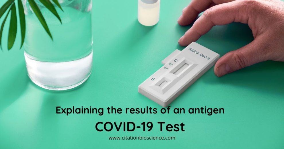 At Home Covid 19 RT PCR Test Kit