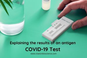At Home Covid 19 RT PCR Test Kit