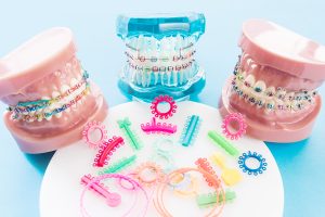 Braces color