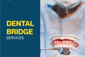 dental bridge services