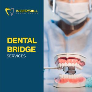 dental bridge