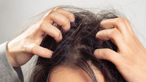 Ways To Get Rid Of Dead Skin Cells