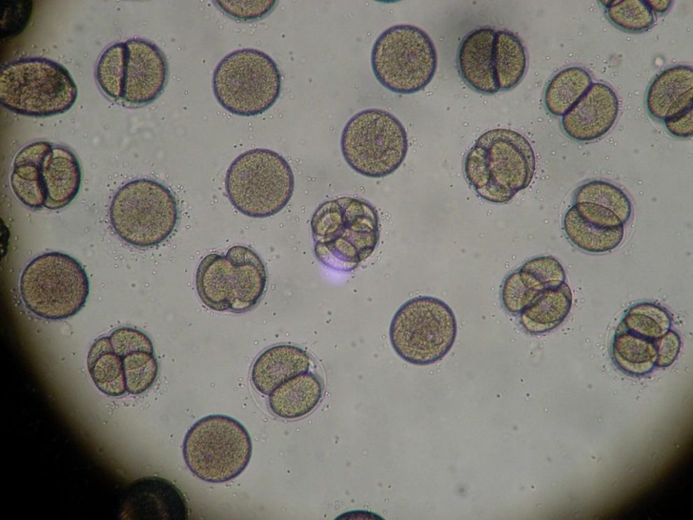 lab Test
