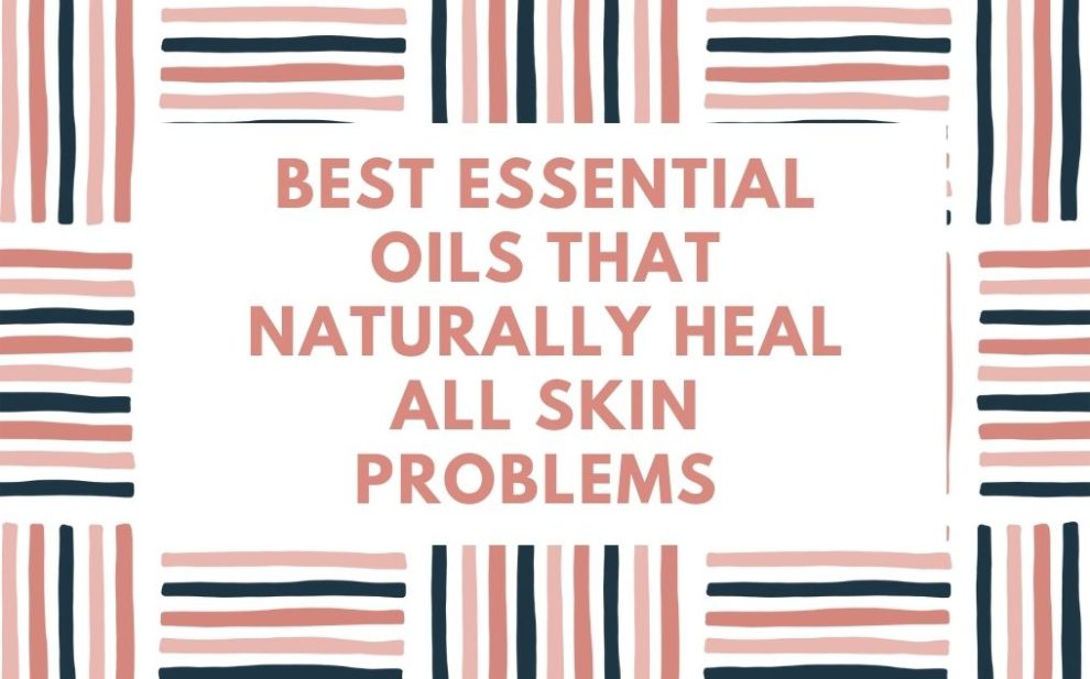 Best Essential Oils That Naturally Heal All Skin Problems 
