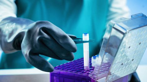Cryogenic Equipment Market