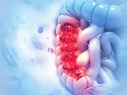 Effect of Colonoscopy