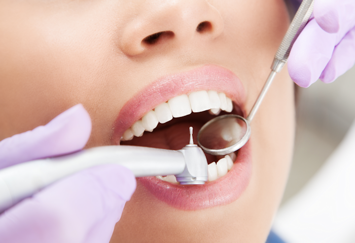 tooth fillings near me