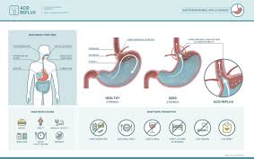 esophagastroduodenoscopy