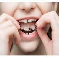 pediatric dentistry la mesa