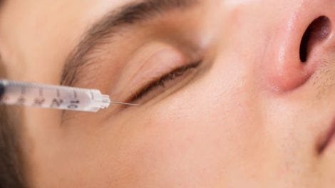 Botox Injections for Wrinkles Around Eyes in Dubai, Abu Dhabi & Sharjah - UAE