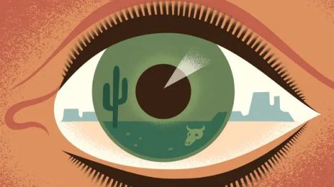 Dry Eye Image