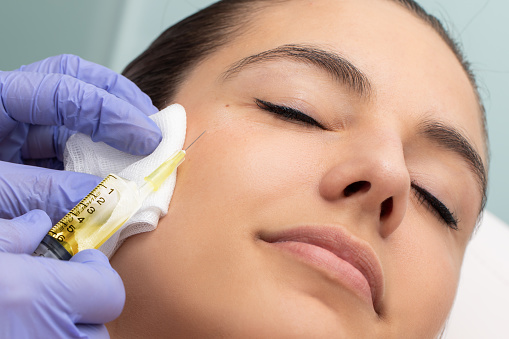 Microneedling Acne Scars