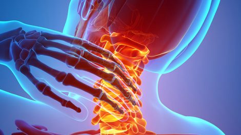 What Are Causes Of Neck Pain & Best Treatments For That?