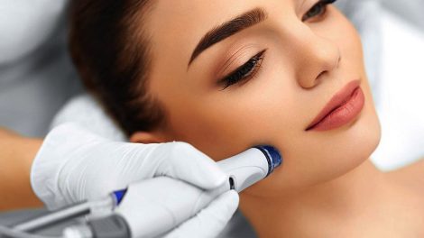 skin pen microneedling