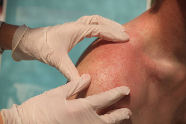 dermatologist encino