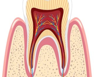 root canal therapy
