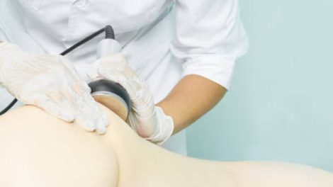 Getting the lymphatic massage after lipo suction may benefit the patient.