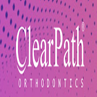 Why Use Removable Braces to Align Teeth?