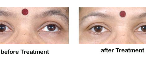 Squint featured image